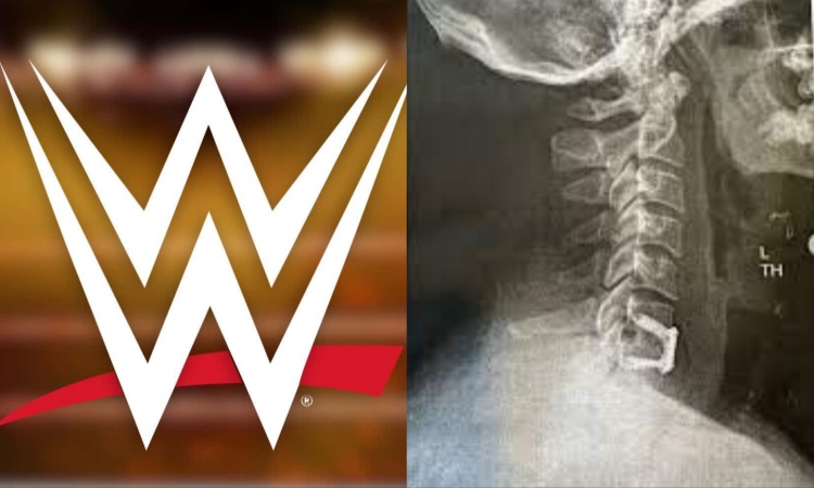 WWE Logo