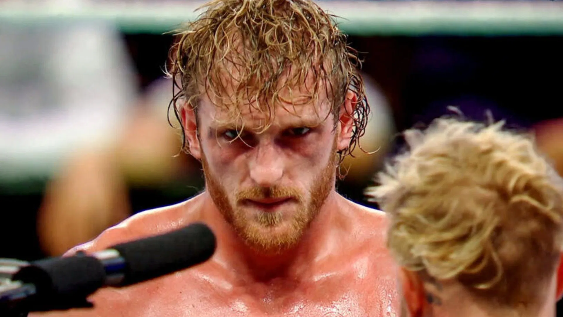 Logan Paul lesionado; estará fuera de acción en la WWE por mucho tiempo Logan Paul