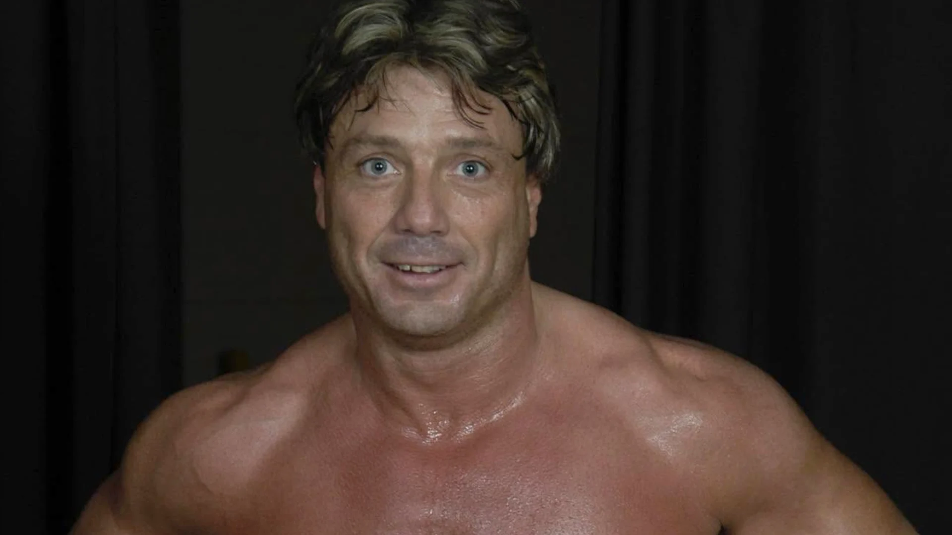 Marty Jannetty informa sobre su recuperación tras la amputación de su rodilla Marty J